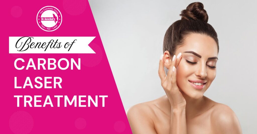 Benefits of Carbon Laser Treatment
