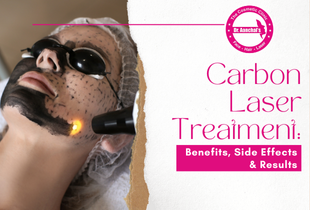 Carbon Laser Treatment