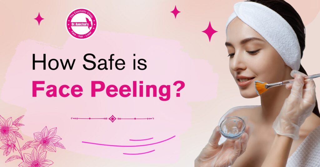 How Safe is Face Peeling?