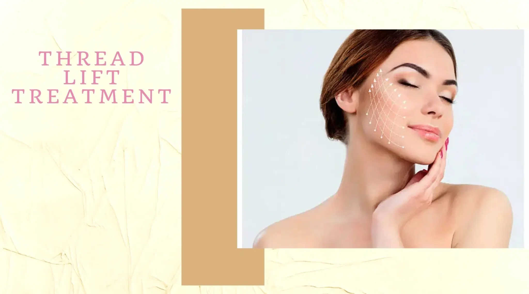 threadlift treatment